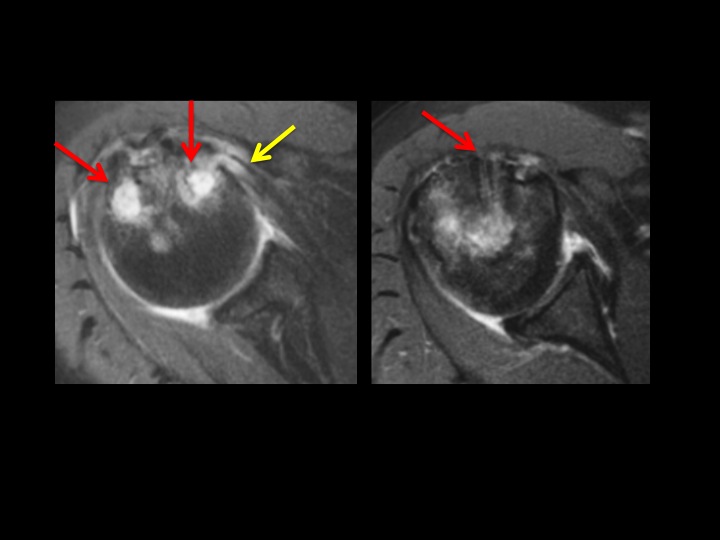 Figure 4 for case fixation device ( RID5471 )